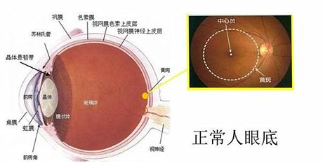 三氧治疗的最新案例分享