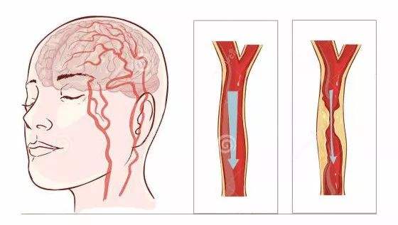 什么是三氧自血疗法？护士的你掌握了吗？