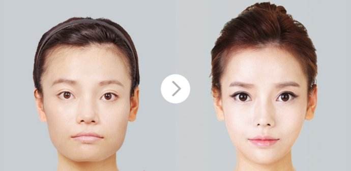 细胞修复治疗仪打造女性小v脸