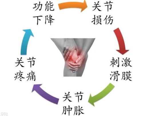 膝关节积液、肿胀？医用三氧疗法轻松缓解关节疼痛，腿疼不求人！