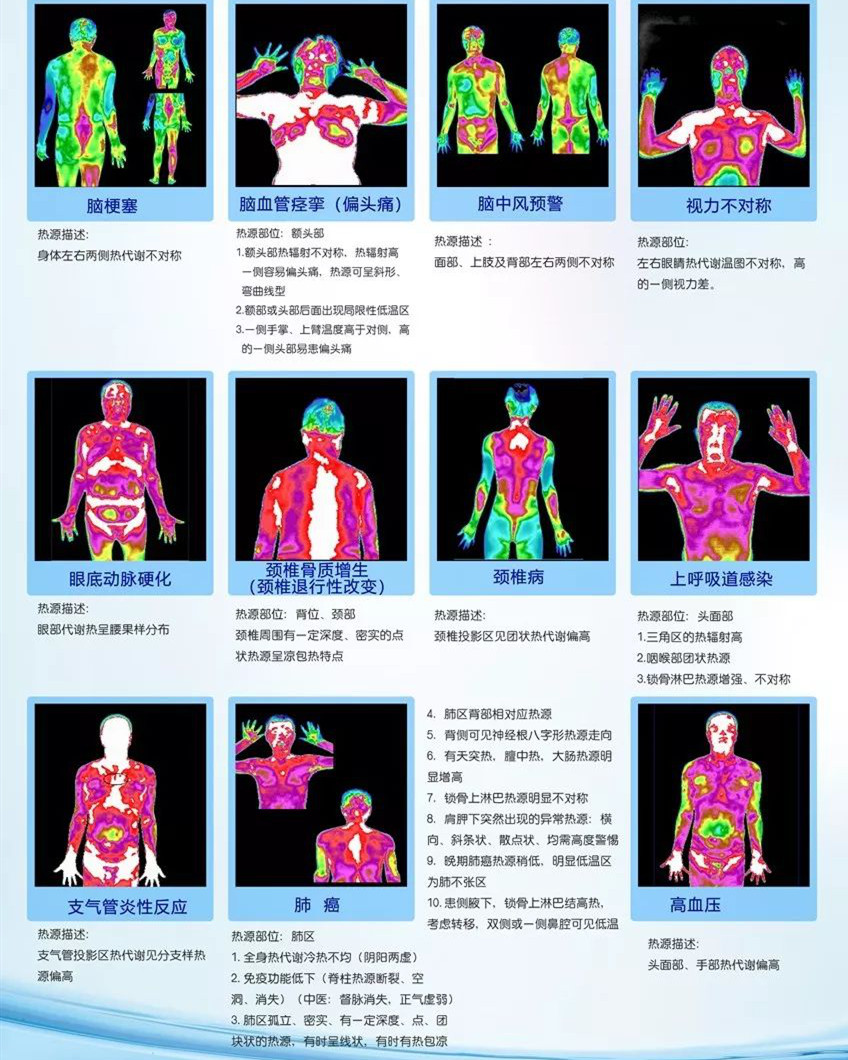 红外热成像|辨寒热，知循环，查未病，早预警 