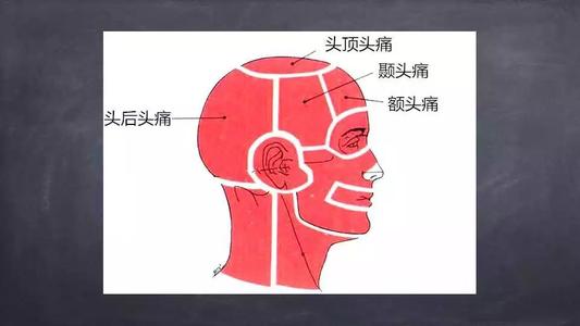 越来越常见的颈源性头痛怎么办—神奇的三氧疗法 越来越常见的颈源性头痛怎么办—神奇的三氧疗法