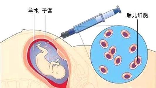 羊水穿刺是否对孕妇和胎儿有危险？