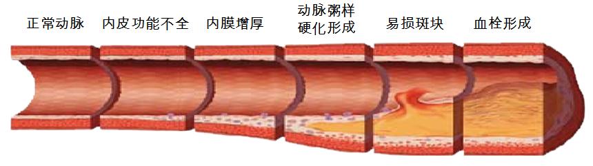 三氧疗法享誉国内外，溶血栓、补充氧、改善功能障碍