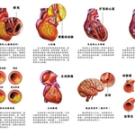 疏通血管 清除杂质 三氧大自血疗法帮你治疗心血管疾病