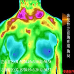 红外热成像技术-疼痛科医生看病的“第三只眼”