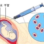 羊水穿刺是否对孕妇和胎儿有危险？